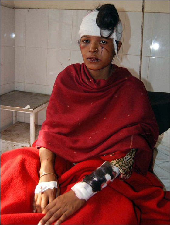 امرأة هندية حامل تنجو بأعجوبة من بين انياب نمر مفترس!  صورة رقم 1