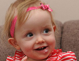 طفلة تبتسم لأول مرة بعد ازالة وحمة شوّهت وجهها!  صورة رقم 1