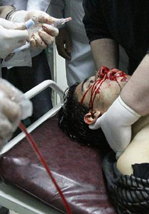 لمنع اسعاف المتظاهرين.. اعتقال 300 طبيب منذ بداية انتفاضة سوريا صورة رقم 1