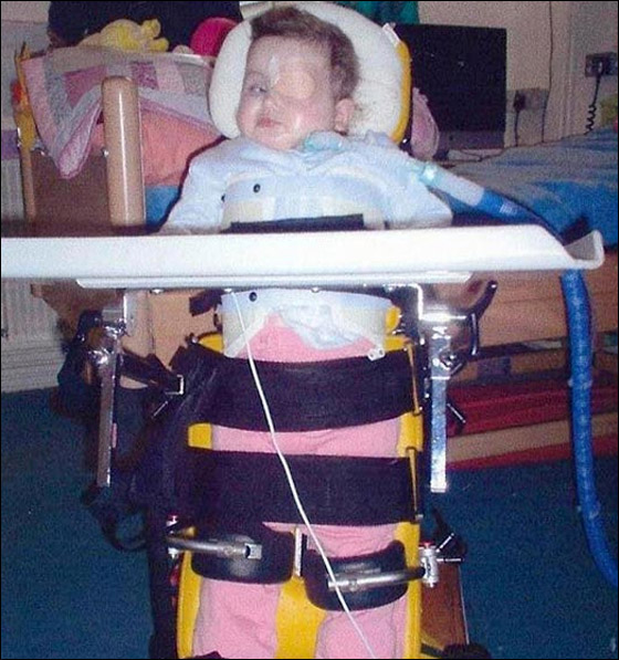 اهل يتلقون جائزة بعد تعرضهم لحادث واصابة طفلتهم بالشلل  صورة رقم 3