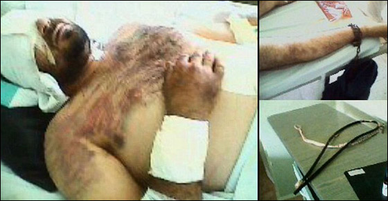 مشفى بحمص يعذب المرضى بالضرب بالسياط والصعق بالكهرباء صورة رقم 4