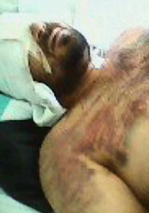 مشفى بحمص يعذب المرضى بالضرب بالسياط والصعق بالكهرباء صورة رقم 1