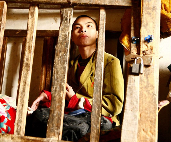 تعرفوا على الشاب الذي قضى معظم ايام حياته داخل قفص خشبي!  صورة رقم 4