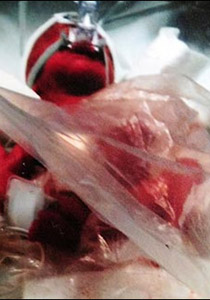 انقاذ حياة رضيعة بحجم التفاحة بوضعها بكيس بلاستيك للسندوتشات صورة رقم 1