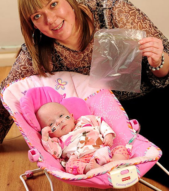 انقاذ حياة رضيعة بحجم التفاحة بوضعها بكيس بلاستيك للسندوتشات صورة رقم 3