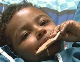 جراحة نادرة لطفل العامين لا يتوقف عن الضحك بسبب ورم في المخ! صورة رقم 1