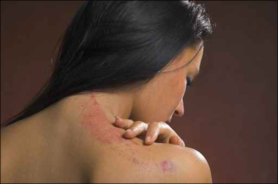 اصيب خلال اغتصاب جارته وادعى ان شبانا عرب هاجموه! صورة رقم 1