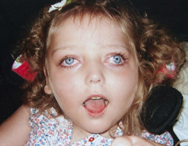 طبيب يخطىء بتشخيص طفلة فتصاب بتلف دماغي دائم! صورة رقم 1 طبيب يخطىء بتشخيص طفلة فتصاب بتلف دماغي دائم! صورة رقم 1