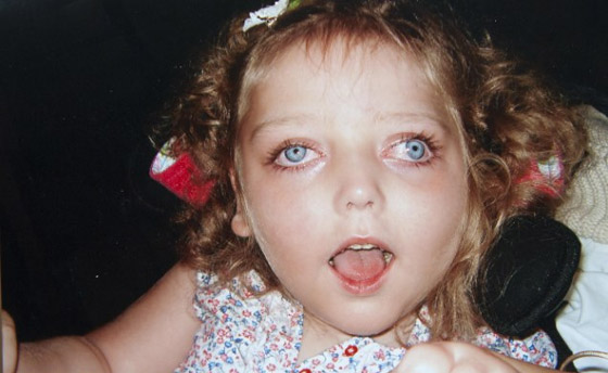 طبيب يخطىء بتشخيص طفلة فتصاب بتلف دماغي دائم! صورة رقم 4 طبيب يخطىء بتشخيص طفلة فتصاب بتلف دماغي دائم! صورة رقم 4