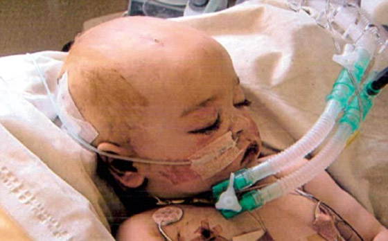 طبيب يخطىء بتشخيص طفلة فتصاب بتلف دماغي دائم! صورة رقم 2 طبيب يخطىء بتشخيص طفلة فتصاب بتلف دماغي دائم! صورة رقم 2