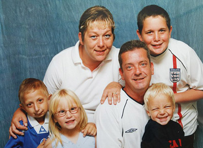 شيخوخة نادرة تصيب شاب بريطاني وتجعله يبدو في 160 من عمره! صورة رقم 7