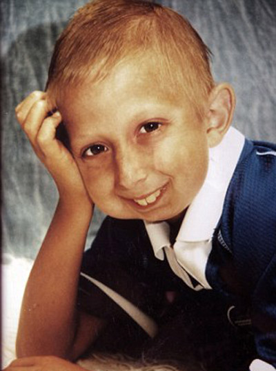 شيخوخة نادرة تصيب شاب بريطاني وتجعله يبدو في 160 من عمره! صورة رقم 10