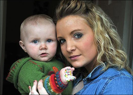 نمس جائع يهاجم طفلة في عربتها ويقضم اصبعها! صورة رقم 2 نمس جائع يهاجم طفلة في عربتها ويقضم اصبعها! صورة رقم 2