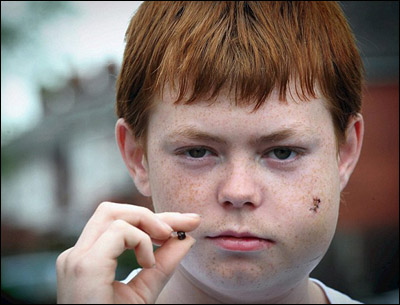 رصاصة تصيب الاعصاب الرئيسية لوجه طالب وتحرمه من الابتسامة صورة رقم 2