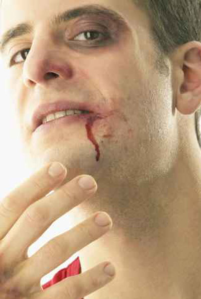 محاكمة امرأة قضمت لسان صديقها وكادت ان تقطعه! صورة رقم 1