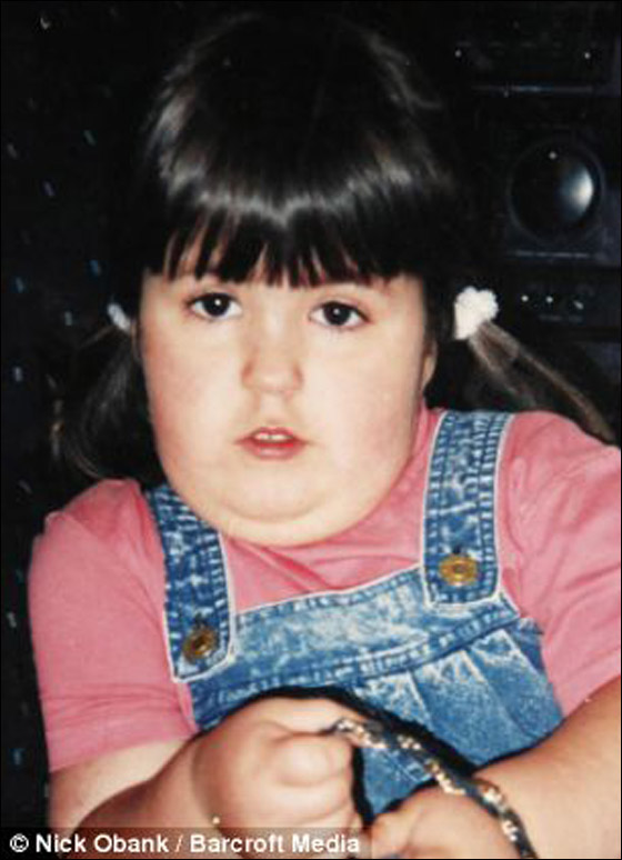 شابة تتناول أكثر من 12 وجبة يومياً وتقضم أجزاء من جسمها!  صورة رقم 2