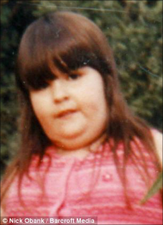 شابة تتناول أكثر من 12 وجبة يومياً وتقضم أجزاء من جسمها!  صورة رقم 1