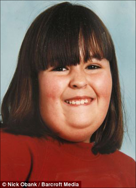 شابة تتناول أكثر من 12 وجبة يومياً وتقضم أجزاء من جسمها!  صورة رقم 3