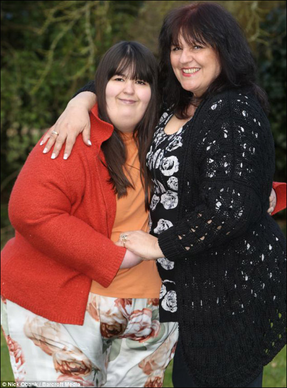 شابة تتناول أكثر من 12 وجبة يومياً وتقضم أجزاء من جسمها!  صورة رقم 6