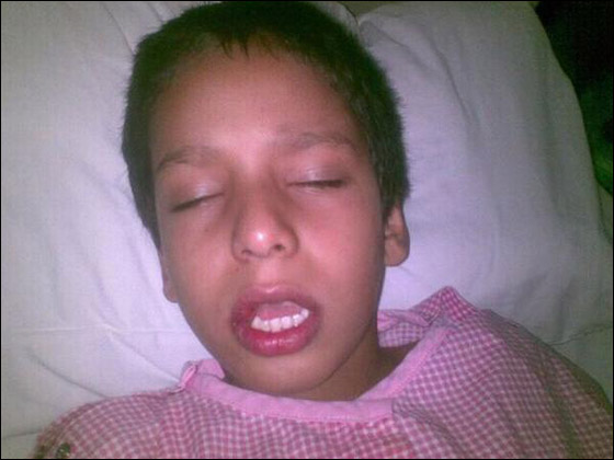 طبيب يكسر أسنان طفل خلال عملية إزالة اللوزتين!! صورة رقم 1 طبيب يكسر أسنان طفل خلال عملية إزالة اللوزتين!! صورة رقم 1