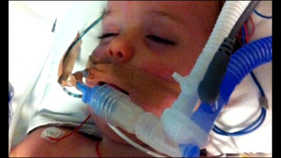 طفل ينجو من الموت بعد توقف قلبه مدة 39 دقيقة بسبب انتفاخ دماغي صورة رقم 2 طفل ينجو من الموت بعد توقف قلبه مدة 39 دقيقة بسبب انتفاخ دماغي صورة رقم 2