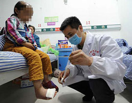 أب صيني يخيط فم ابنته ويقلع شعرها ويحرق رأسها صورة رقم 1