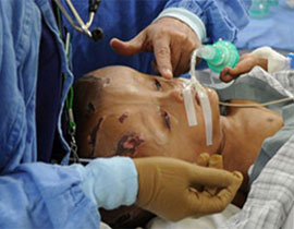 بالصور: الطفلة ذات الرأس المنتفخ تتعافى لكن مستقبلها في خطر صورة رقم 1