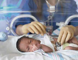 معجزة: طفلة عربية استطاعت ان تصمد رغم ولادتها في الأسبوع 23 صورة رقم 1