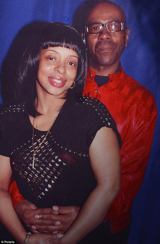 حبيبته خرقت راسه برصاصة ويرفض التخلي عنها صورة رقم 2 حبيبته خرقت راسه برصاصة ويرفض التخلي عنها صورة رقم 2