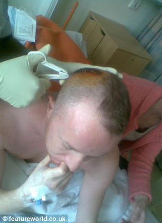 رزق بطفلة وأدهش الاطباء الذين أكدوا عقمه بعد علاج مكثف صورة رقم 5 رزق بطفلة وأدهش الاطباء الذين أكدوا عقمه بعد علاج مكثف صورة رقم 5