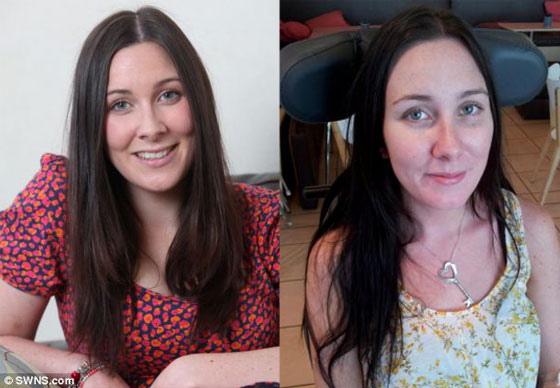 امراة تصاب بالشلل وتكاد تموت بسبب لسعة بعوضة  صورة رقم 5