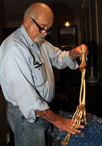 طبيب امريكي يعيد لجندي فيتنامي يده المبتورة منذ 35 عاما صورة رقم 1