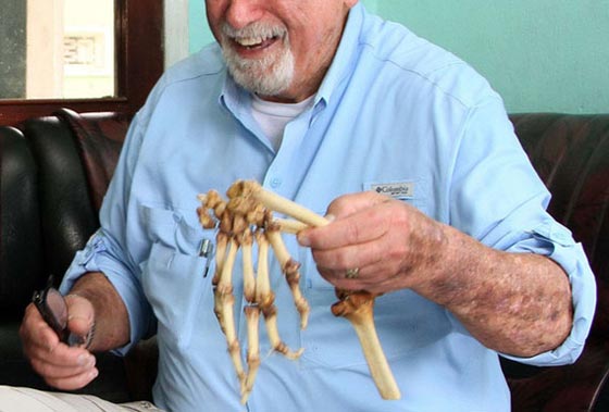 طبيب امريكي يعيد لجندي فيتنامي يده المبتورة منذ 35 عاما صورة رقم 4 طبيب امريكي يعيد لجندي فيتنامي يده المبتورة منذ 35 عاما صورة رقم 4