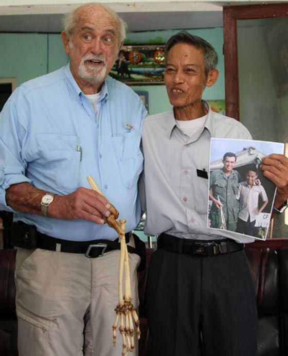 طبيب امريكي يعيد لجندي فيتنامي يده المبتورة منذ 35 عاما صورة رقم 5 طبيب امريكي يعيد لجندي فيتنامي يده المبتورة منذ 35 عاما صورة رقم 5