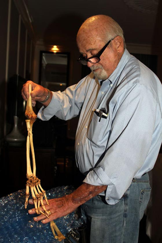 طبيب امريكي يعيد لجندي فيتنامي يده المبتورة منذ 35 عاما صورة رقم 6 طبيب امريكي يعيد لجندي فيتنامي يده المبتورة منذ 35 عاما صورة رقم 6