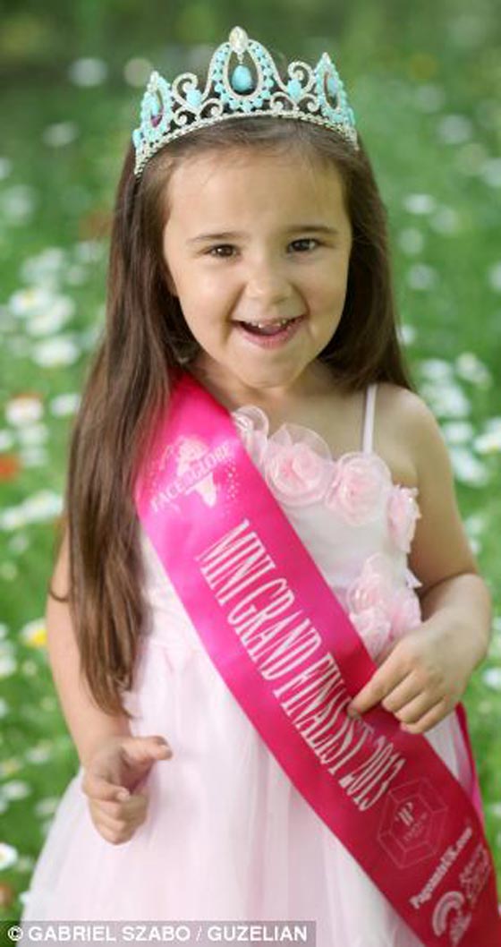 نجت من الموت وتشارك في مسابقة ديزني لاند (أجمل وجه على الأرض) صورة رقم 4