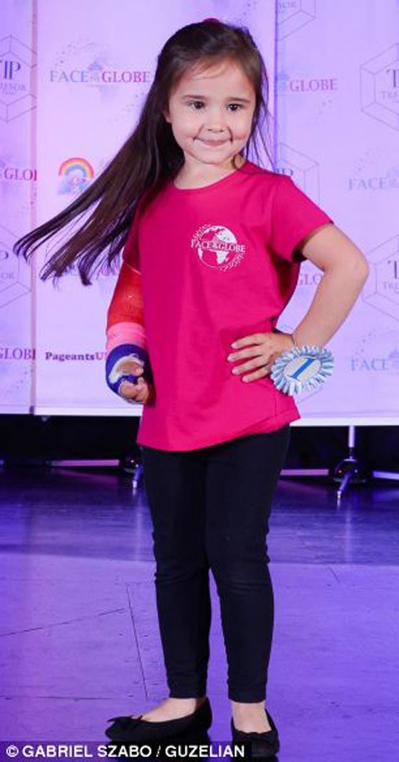 نجت من الموت وتشارك في مسابقة ديزني لاند (أجمل وجه على الأرض) صورة رقم 7