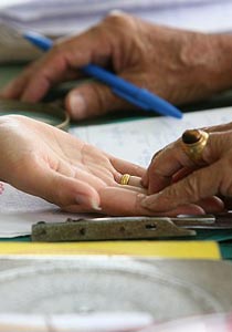 جنون الناس في اليابان: جراحة تعديل خطوط كف اليد لتغيير الحظ  صورة رقم 1