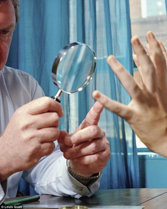 جنون الناس في اليابان: جراحة تعديل خطوط كف اليد لتغيير الحظ  صورة رقم 3