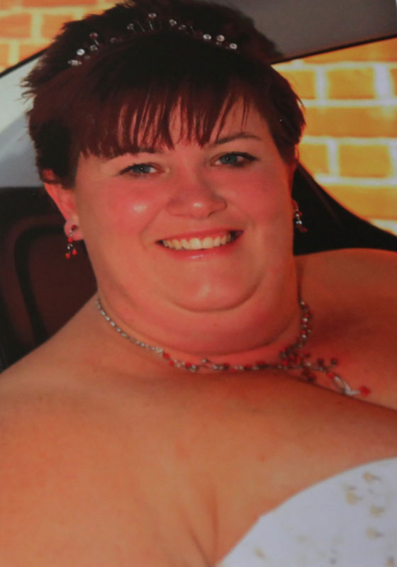 خطأ جراح يقتل سيدة قامت بعملية تصغير معدتها لتنزل من وزنها صورة رقم 1