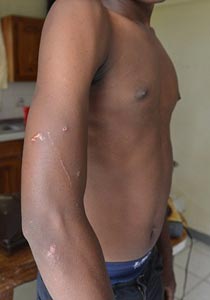 جامايكا: مقتل مراهق شاذ بشكل فاحش (مخنث) لأنه ارتدى ملابس نسائية صورة رقم 1