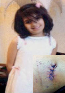 اكتشاف رصاصة في احشاء طفلة أصيبت بها يوم العيد ولم تشعر صورة رقم 1