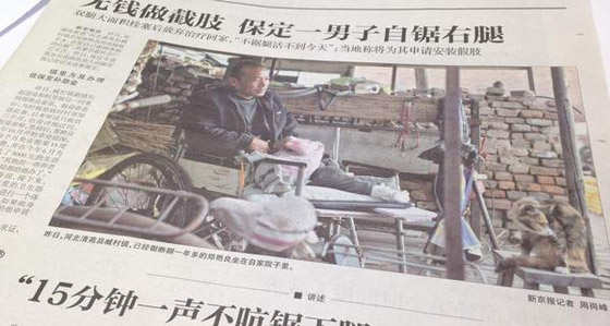 الصين: عجز عن توفير تكاليف العملية فقطع ساقه بسكين ومنشار صورة رقم 1