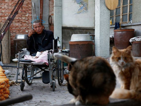 الصين: عجز عن توفير تكاليف العملية فقطع ساقه بسكين ومنشار صورة رقم 6