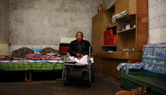 الصين: عجز عن توفير تكاليف العملية فقطع ساقه بسكين ومنشار صورة رقم 7