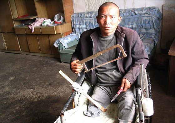 الصين: عجز عن توفير تكاليف العملية فقطع ساقه بسكين ومنشار صورة رقم 8