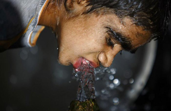 بالصور.. عائلة هندية تتخلص من متلازمة الذئبة بعلاج الليزر صورة رقم 11