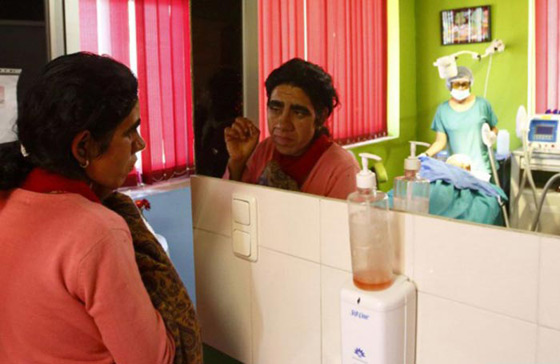 بالصور.. عائلة هندية تتخلص من متلازمة الذئبة بعلاج الليزر صورة رقم 12