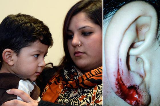 من مزق واكل قطعة كبيرة من اذن طفل في الحضانة؟ صورة رقم 1