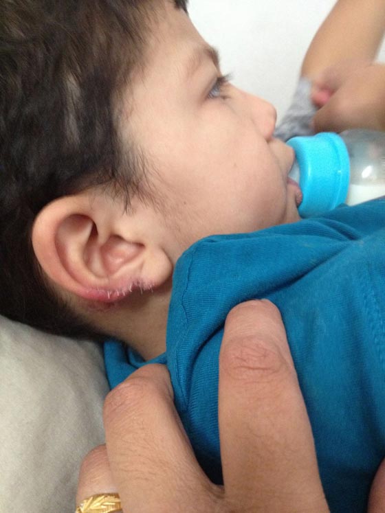 من مزق واكل قطعة كبيرة من اذن طفل في الحضانة؟ صورة رقم 4